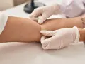 Po pobraniu krwi, pielęgniarka zakłada plaster na ramię. Czy po pobraniu krwi można iść na siłownię? Zależy od samopoczucia.