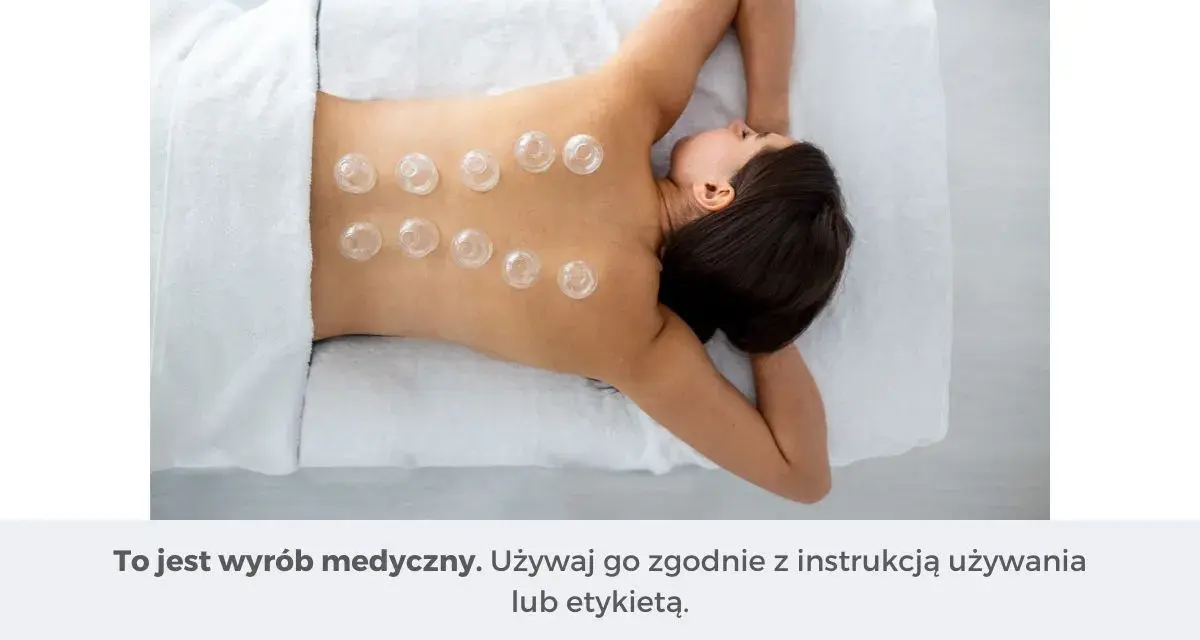 Kobieta z bańkami bezogniowymi na plecach. Dowiedz się, jak stawiać bańki bezogniowe, by cieszyć się relaksem i ulgą.