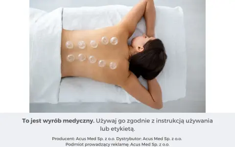Kobieta z bańkami bezogniowymi na plecach. Dowiedz się, jak stawiać bańki bezogniowe, by cieszyć się relaksem i ulgą.