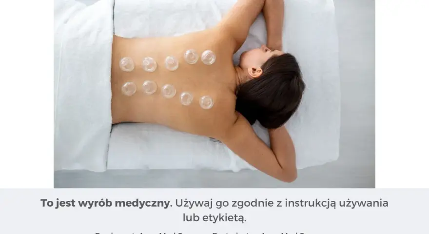 Kobieta z bańkami bezogniowymi na plecach. Dowiedz się, jak stawiać bańki bezogniowe, by cieszyć się relaksem i ulgą.