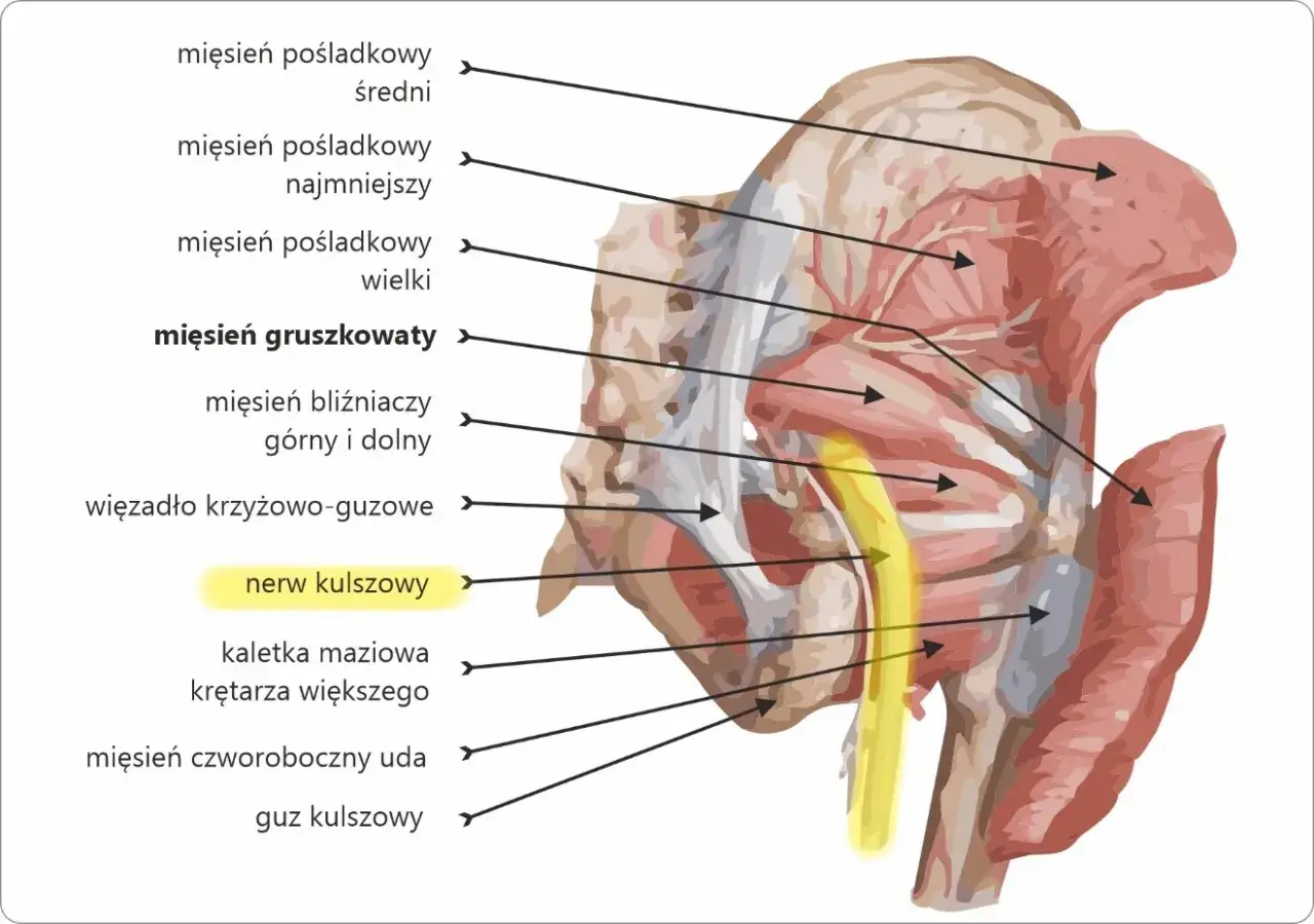 Anatomia miednicy: mięsień gruszkowaty i nerw kulszowy. Wyobraź sobie, że to mięsień gruszkowaty jest jak siodełko roweru, a nerw kulszowy jak jego rama.